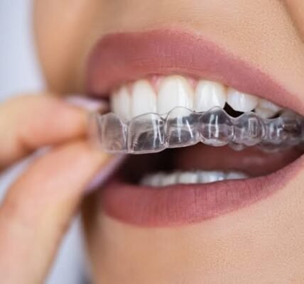 Understanding Clear Aligners: A Modern Approach to a Straighter Smile